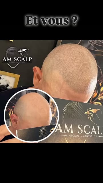 Le tatouage capillaire vous connaissez ? Passez de chauve à rasé ! ⭐️

Qu'en pensez vous ? 😎

Qui d