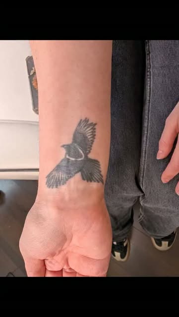 🌟¿Quieres eliminar ese tatuaje que tanto te molesta? 
Con el láser NDYAG de Picosegundo lo hacemos 