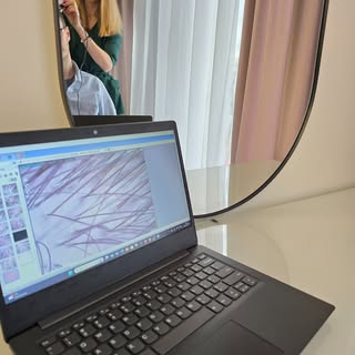 Na czym polega trichoskopia? 

To badanie skóry głowy oraz włosów specjalistyczną kamerą w dużym pow