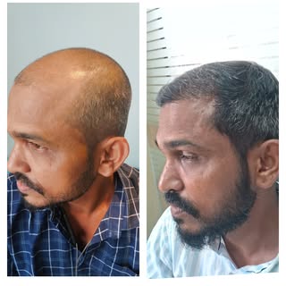 Sharing a transformative story of our trustee! It's just 3 months and one can see drastic changes in