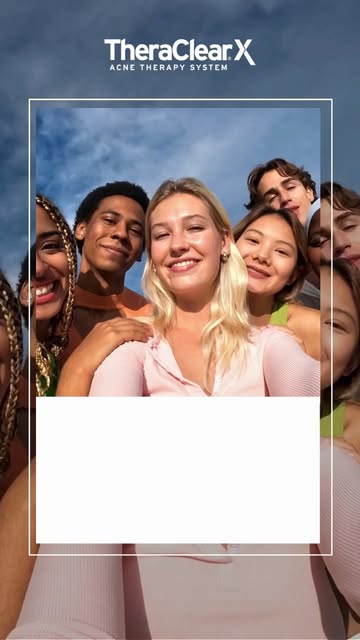 See the difference. TheraClearX helps treat mild-to-moderate acne over a series of treatments, 
supp
