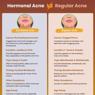 ✨ Hormonal Acne vs Regular Acne – Know the Difference! ✨

Not all acne is the same. While hormonal a