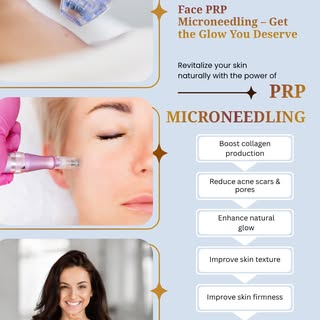 ✨ Reveal Your Skin's Natural Glow with Face PRP Microneedling ✨

Looking for smoother, firmer, and h