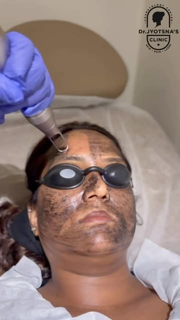 Hyperpigmentation doesn’t always have one cause.

Sun exposure, hormonal changes, acne and inflammat