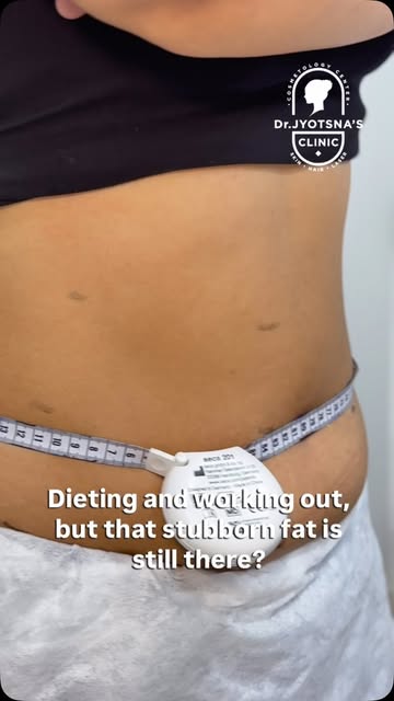 Fat-reduction treatments target stubborn areas by acting on fat cells beneath the skin, helping redu