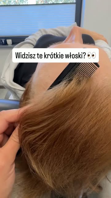Baby hair, które cieszą najbardziej 🤎
W terapii wypadania włosów nie zawsze liczy się szybki efekt.