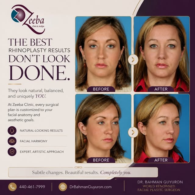The best rhinoplasty results don't look "done."
They look natural, balanced, and uniquely YOU.

At Z