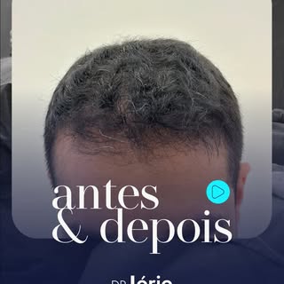 #TBT de uma história que vale a pena relembrar. ✨

Quando o resultado vai além da estética e impacta
