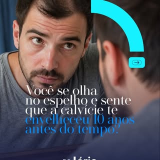 Somando o valor gasto por anos com produtos paliativos e bonés para disfarçar as entradas, fica clar
