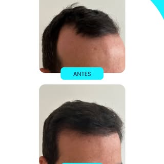 Cada transformação começa com um diagnóstico detalhado e uma técnica adequada ao caso do paciente. O