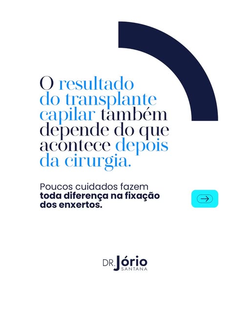 O sucesso do transplante capilar não depende só da cirurgia, mas também dos cuidados após o procedim