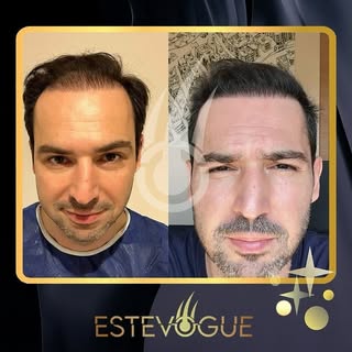 🇬🇧 We have been treating patients from all over the world in Istanbul for many years. 👍💉👩‍⚕️😊
