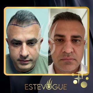 🇬🇧 After the operation we are more than happy to see the final results 💯 🤩

Contact us now on Wh