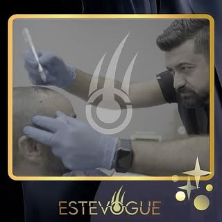 🇬🇧 After designing the hair, we complete the process by placing the roots we have taken where need