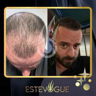 🇬🇧 After the operation we are more than happy to see the final results 💯 🤩

Contact us now on Wh