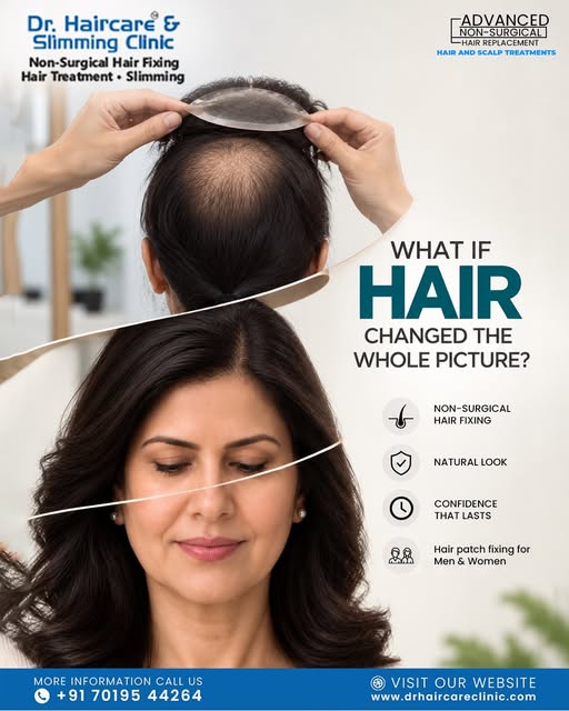 Hair loss can change the way you see yourself — but the right hair solution can help you feel like y