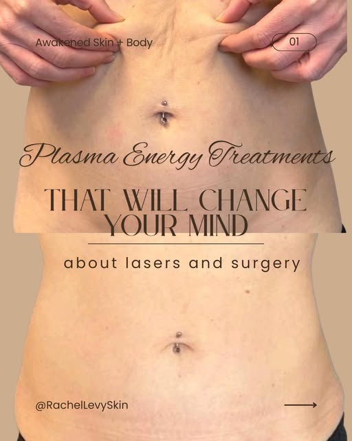 What if a skin treatment could do more than create damage and wait for your body to repair it? ⚡️

T