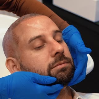 Realizar a drenagem facial durante o transplante capilar faz toda a diferença no pós-operatório.

Me