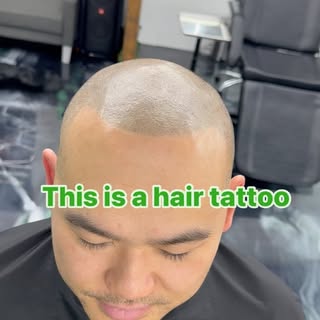 This is a hair tattoo if done correctly No one will ever know.
Scalp micro pigmentation at finishing