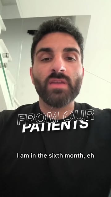 🇮🇹 He came to Turkey for a hair transplant 6 months ago. Today, he's sharing his results.

"I'm tr