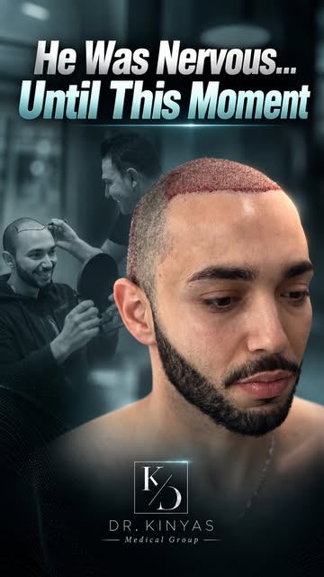 What makes a nervous patient feel calm before a hair transplant? 

For our patient, the answer was s