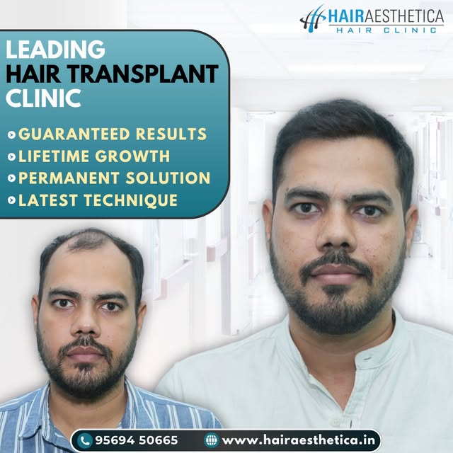 Restore the look you remember, naturally.

Tags: natural looking hair, hair growth, hair transplant,