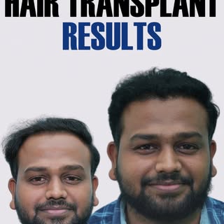Precision techniques for a naturally confident transformation.

Tags: natural looking hair, hair gro