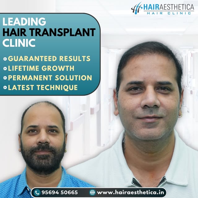 Natural-looking results powered by advanced techniques.

Tags: natural looking hair, hair growth, ha