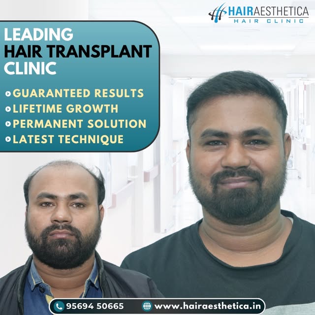 Your hairline deserves a thoughtful approach.

Tags: natural looking hair, hair growth, hair transpl
