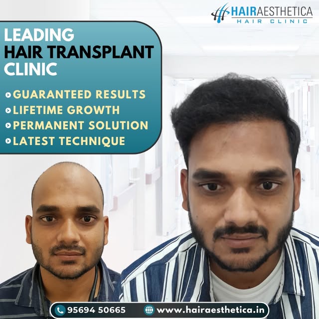 A refined hairline. A renewed sense of confidence.

Tags: natural looking hair, hair growth, hair tr