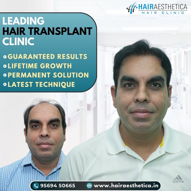 The right approach can transform the way you feel.

Tags: natural looking hair, hair growth, hair tr