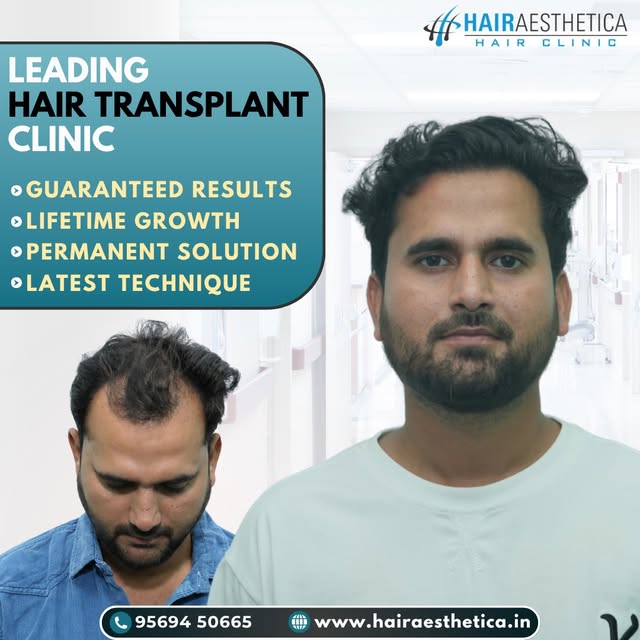 Hair restoration designed to match your features and lifestyle.

Tags: natural looking hair, hair gr