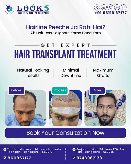 Hairline peeche ja rahi hai? It’s time to take action. 💙
Hair loss ko ignore karne ke bajaye, get e
