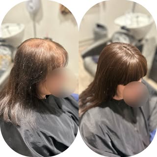 This amazing lady took the bold step to embrace an integrated hair system after years of dealing wit