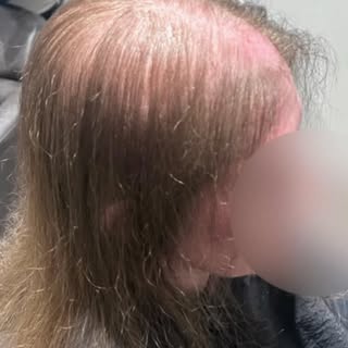 New system day for this lady today 😍 #hairlosstips #hairintegrationsystem #beforevsafter