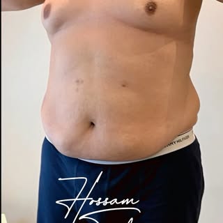 When experience meets precision, the results speak for themselves.

#MensAesthetics #MaleTransformat