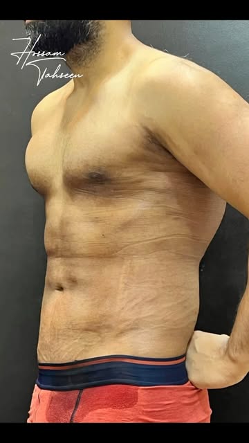 This isn’t just a before & after…
It’s a transformation you can feel.

Because real transformation g