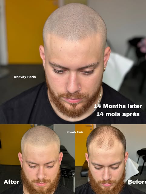 SMP 14 MOIS APRÈS le début de l’aventure… 🔥 et c’est toujours aussi impressionnant . Un changement 