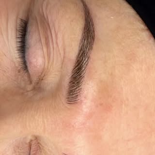 ✨ From scar to symmetry ✨
Thanks to Microblading, we covered her surgery scar and gave her brows a n