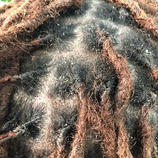 When you see little white casts at the root of your hair strands it means the style was done too tig