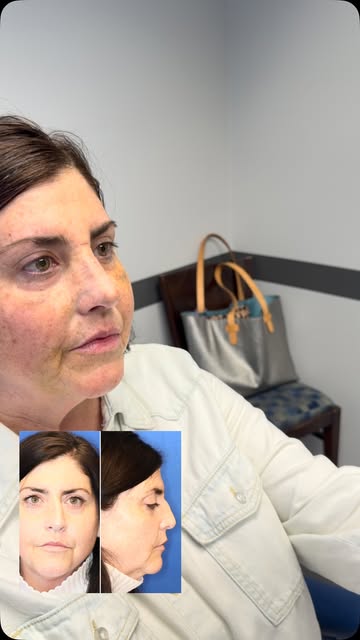 At any age,  to finally have your nose appear the way you have always seen yourself is still quite s