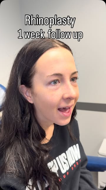 Creating the proper nose for my wonderful patient was a team effort. She had very concrete ideas of 