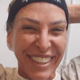 השתלת שיער בגבות ❔❔
תשכחו מכל מה שהכרתן.
טיפול חדשני שמבטיח שיערות בגבות❕
לא בצורה מלאכותית , ללא אי