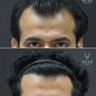 A hairline doesn’t need to be loud. It just needs to look like it was always meant to be there 🧑🏻‍