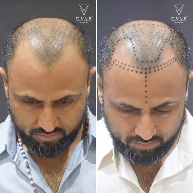 Some transformations are more than just a before and after and this one here is one of the most chal