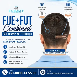 **FUE + FUT Combined Hair Transplant Technique**

Get maximum graft coverage by combining the precis