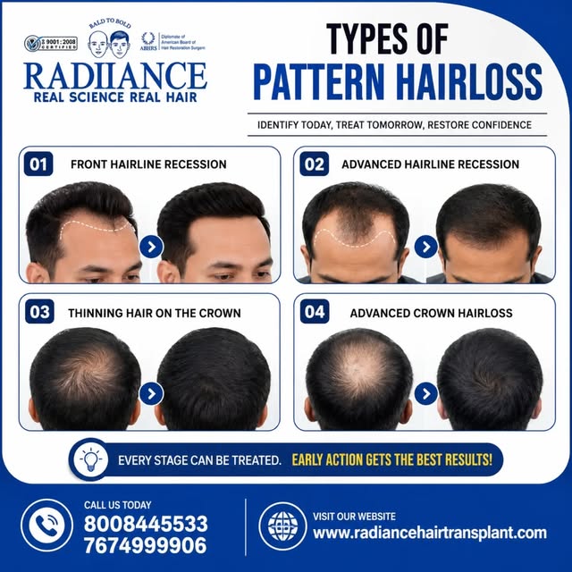 TYPES OF PATTERN HAIR LOSS

Hair loss can develop gradually—and identifying the pattern early can he