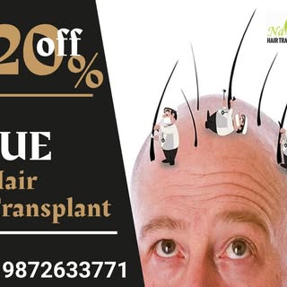 Regrow your Hair Today Get  FUE hair Transplant
✅20% off
✅Get Free Consultation.

Call Now to Talk w