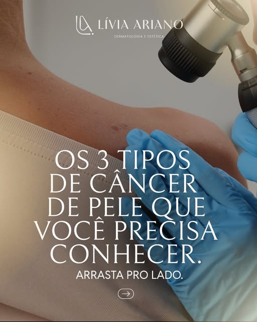 🌸 Os 3 tipos de câncer de pele que você precisa conhecer.

Nem toda lesão na pele é câncer, mas tod