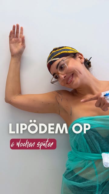 Sechs Wochen nach der Lipödem OP 🦢

@dr.tarekalmalat nimmt euch heute mit zur Kontrolle und zeigt e